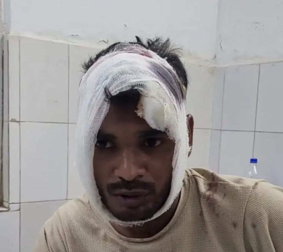 आज़मगढ़: बाइक सवार बदमाशों ने युवक से की लूट, विरोध करने पर फोड़ा सिर