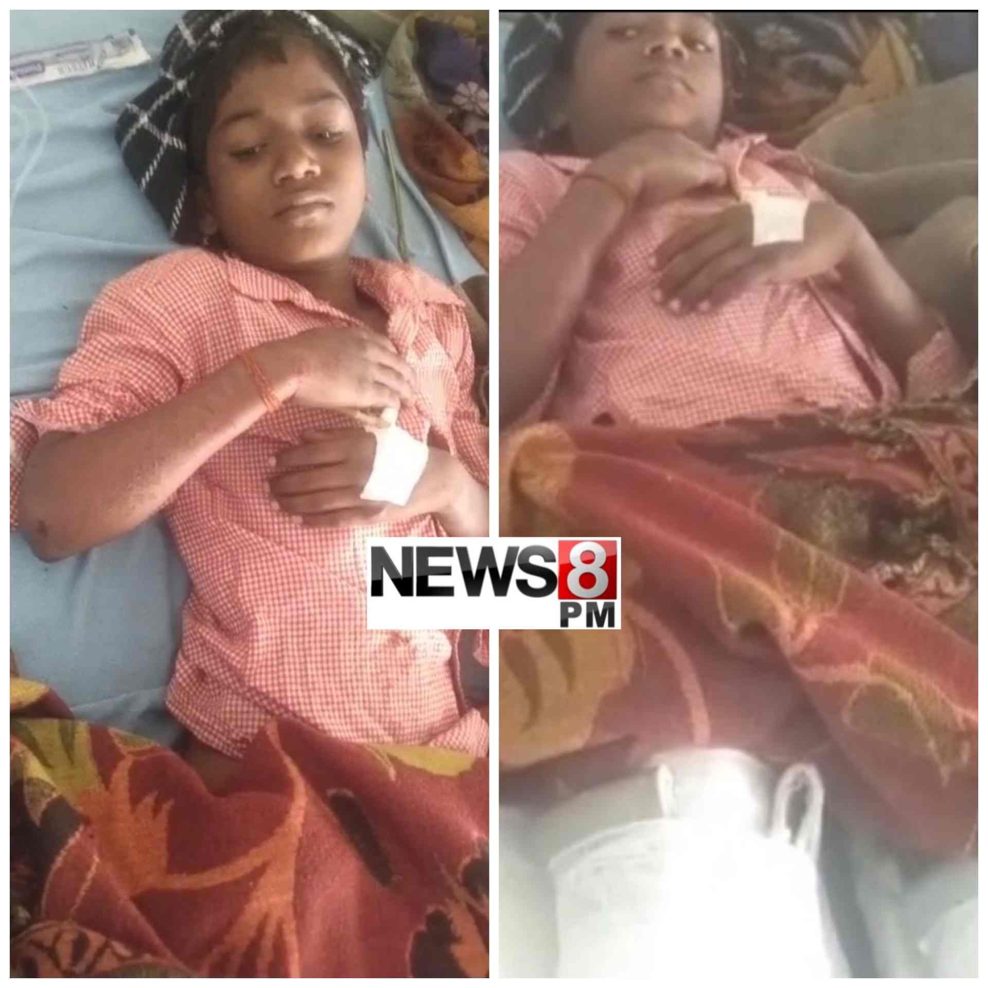 आज़मगढ़: स्कूल बस की रफ्तार ने तोड़ा छात्र के सपनों का कदम, दोनों पैर फ्रैक्चर