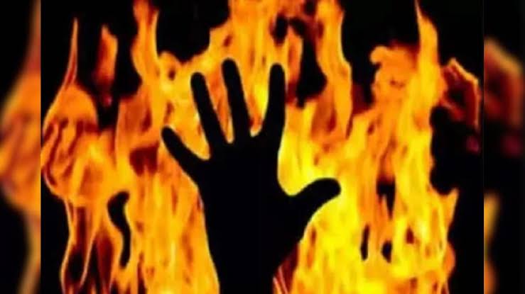 आज़मगढ़:खेल-खेल में विवाद बना खौफनाक, बच्चे को पेट्रोल डालकर जलाया